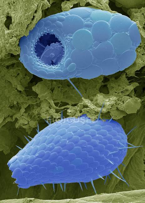 Micrografo elettronico a scansione colorata di tubulo seminifero sezionato, sito di produzione di sperma nei testicoli umani
. — Foto stock