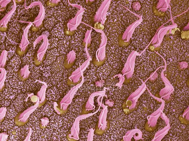 Micrografia eletrônica de varredura colorida de feixes de células sensoriais de cílios em mácula utriculi dentro do labirinto do ouvido interno humano . — Fotografia de Stock