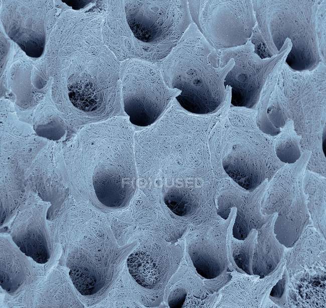 Imagem colorida de micrografia eletrônica de varredura de dentina dentária, tecido conjuntivo mineralizado encontrado sob esmalte dentário . — Fotografia de Stock