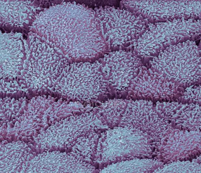 Кольоровий скануючий електронний мікрограф, що показує уретральний епітелій уретри.. — стокове фото