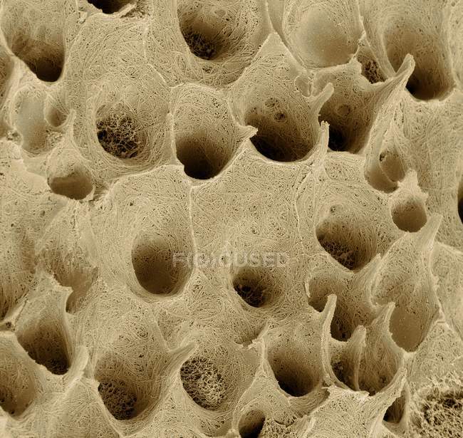 Imagem colorida de micrografia eletrônica de varredura de dentina dentária, tecido conjuntivo mineralizado encontrado sob esmalte dentário . — Fotografia de Stock