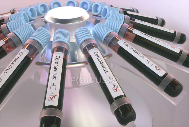 Vials of blood in laboratory centrifuge testing for coronavirus infection, conceptual digital illustration. — Stock Photo