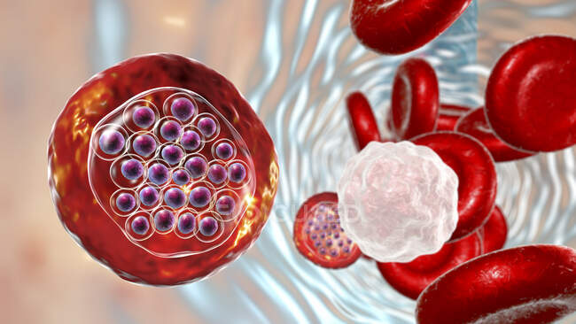 Plasmodium falciparum protozoário dentro de glóbulos vermelhos, ilustração do computador — Fotografia de Stock