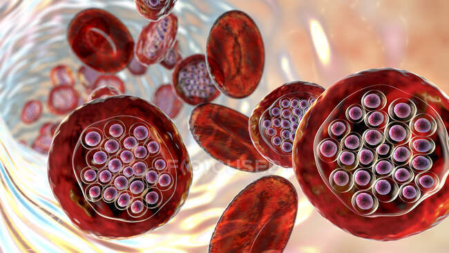 Plasmodium falciparum protozoo dentro de los glóbulos rojos, ilustración por ordenador - foto de stock