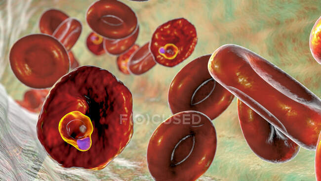 Protozoo dell'ovale del plasmodio all'interno dei globuli rossi allo stadio di trofozoite ad anello, illustrazione del computer — Foto stock
