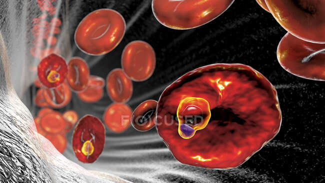 Protozoo oval de Plasmodium dentro de los glóbulos rojos en la etapa de trofozoito en forma de anillo, ilustración por ordenador - foto de stock