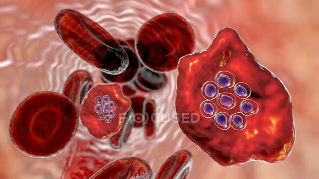 Plasmodium ovale protozoan all'interno dei globuli rossi nella fase di schizont, illustrazione del computer — Foto stock