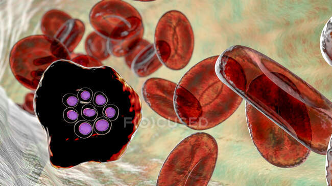 Plasmodium ovale protozoan inside red blood cells in the stage of schizont, computer illustration — Stock Photo
