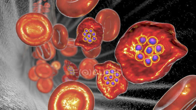 Plasmodium ovale protozoan всередині червонокрівців на етапі шизону, комп'ютерна ілюстрація — стокове фото