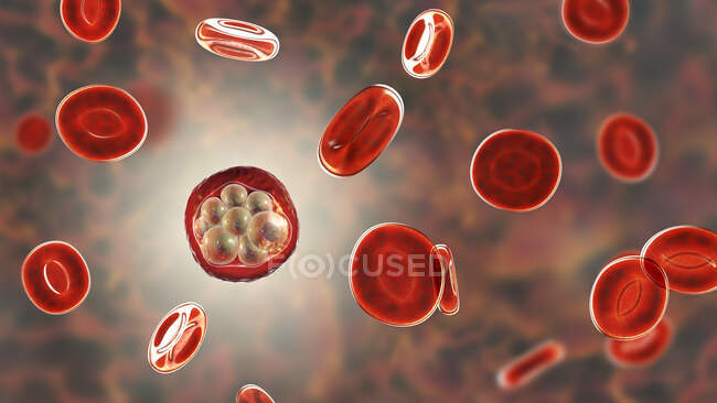 Blood cells and Plasmodium sp. parasites (at schizont stage) causing malaria, computer illustration. — Stock Photo