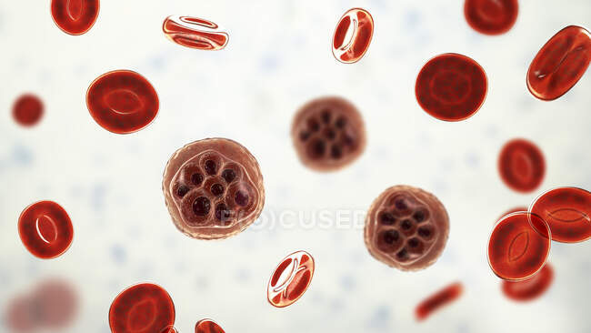 Blood cells and Plasmodium sp. parasites (at schizont stage) causing malaria, computer illustration. — Stock Photo