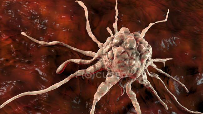 Krebszelle, Computerillustration — Stockfoto