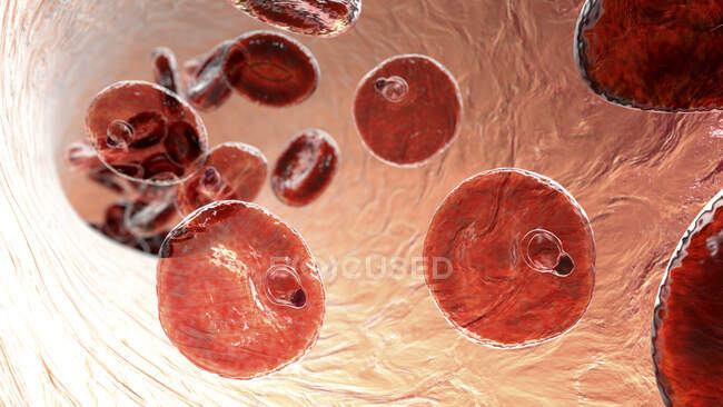 Protozoário de Plasmodium malariae no interior dos glóbulos vermelhos na fase do trofozoíto em forma de anel, ilustração do computador — Fotografia de Stock