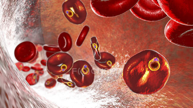 Plasmodium malariae protozoan inside red blood cells in the ring-form trophozoite stage, computer illustration — Stock Photo