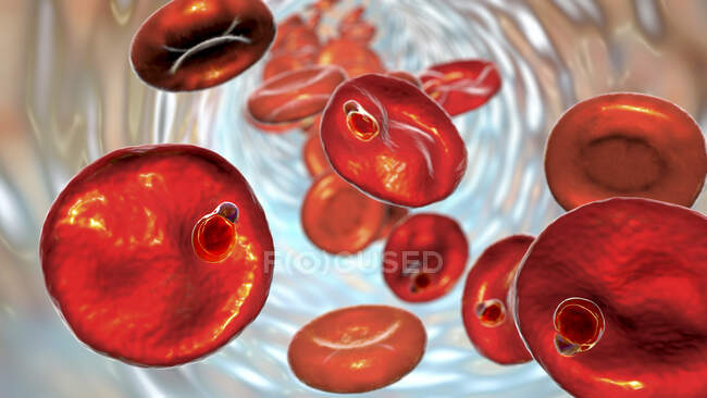 Protozoo de Plasmodium malariae dentro de los glóbulos rojos en la etapa del trofozoito en forma de anillo, ilustración por ordenador - foto de stock