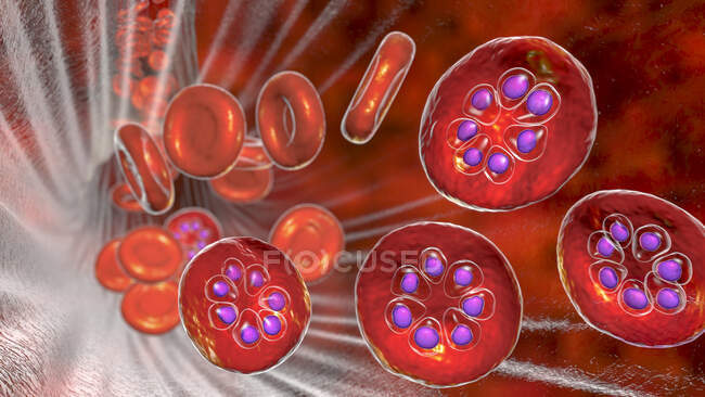 Protozoan Plasmodium malariae inside red blood cell in the schizont stage, computer illustration — стоковое фото