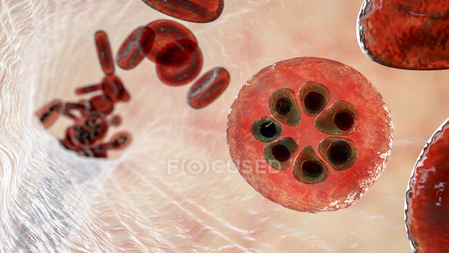 Protozoan Plasmodium malariae inside red blood cell in the schizont stage, computer illustration — стоковое фото