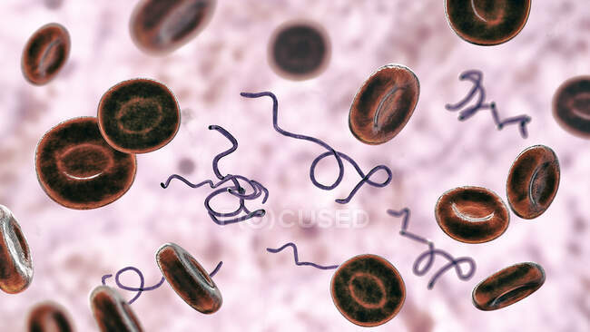 Ilustración por ordenador de la bacteria Borrelia en la sangre - foto de stock