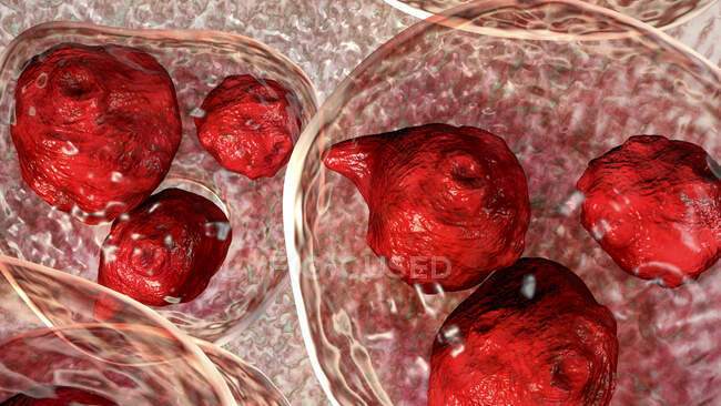 Echinococcus granulosus hydatid cyst, компьютерная иллюстрация — стоковое фото
