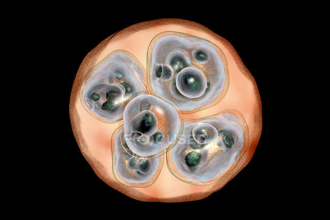 Echinococcosis multilocularis hydatid cyst, computer illustration — Stock Photo