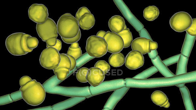 Malassezia hongo de la piel, ilustración por ordenador - foto de stock
