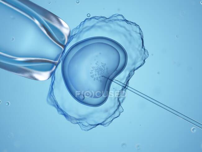 In vitro fertilisation, computer illustration — Stock Photo
