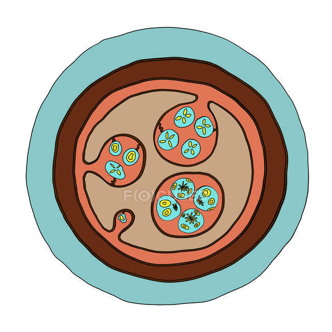 Quiste hidatídico de Echinococcus granulosus, ilustración por ordenador - foto de stock