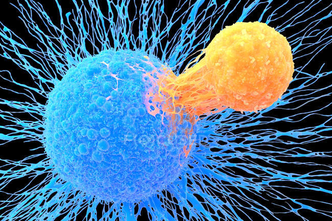 T-Lymphozyte (orange) an einer Krebszelle (blau), Abbildung. T-Lymphozyten sind eine Art weißer Blutkörperchen, die im Thymus heranreifen. — Stockfoto