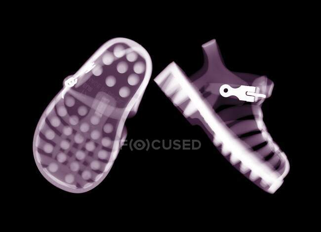 Par de sapatos de geléia da criança, raio X colorido. — Fotografia de Stock