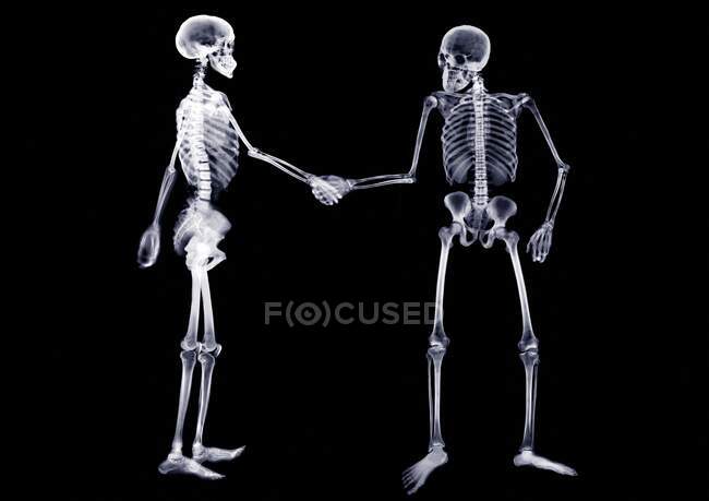Два скелети трясуться руками, рентгенівський знімок . — стокове фото