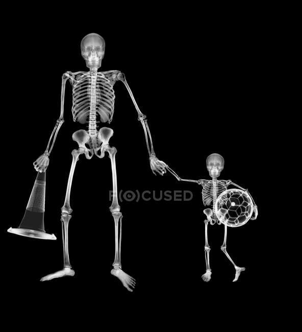 Esqueleto adulto levando esqueleto infantil para o futebol, raio-X. — Fotografia de Stock