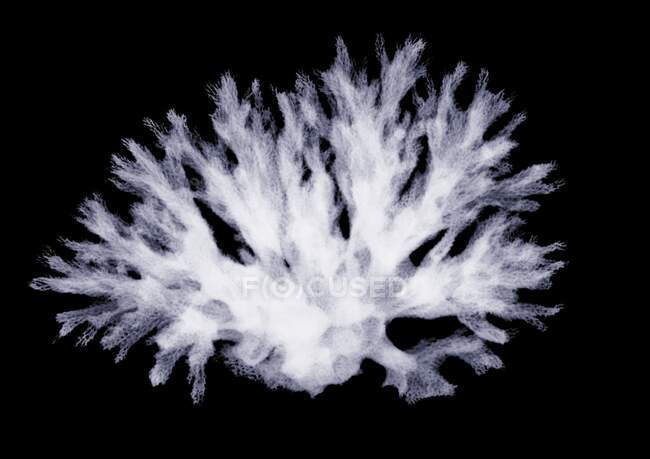 Koralle, Röntgen, Radiologie-Scan — Stockfoto