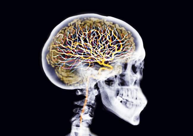 Череп, що показує мозок та нейрони, кольоровий рентгенівський знімок . — стокове фото