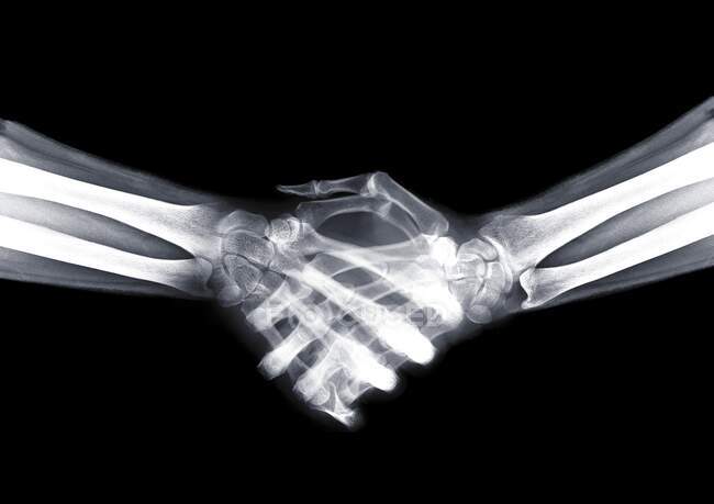 Apretón de manos, rayos X, exploración radiológica - foto de stock