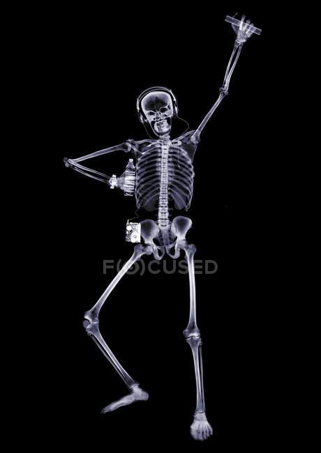 Persona che balla con il bastone incandescente, raggi X. — Foto stock