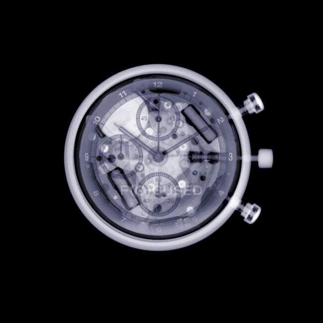 Cronômetro, raio-X, varredura de radiologia — Fotografia de Stock