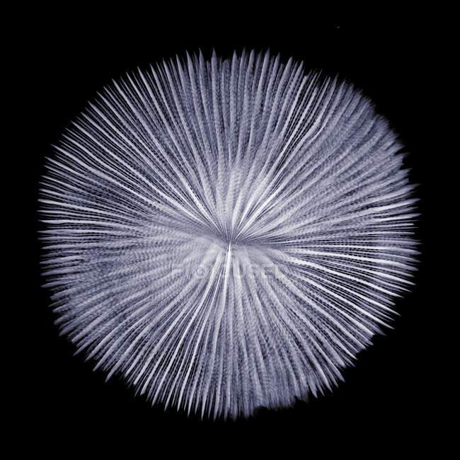 Коралловое, рентгеновское, рентгенологическое сканирование — стоковое фото