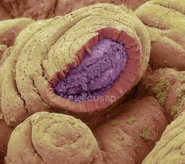 Rivestimento intestinale. Micrografo elettronico a scansione colorata (SEM) di una frattura congelata dell'intestino tenue. La superficie è costituita da pieghe profonde, chiamate villi. La superficie intestinale (gialla) è esposta al cibo — Foto stock