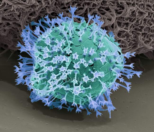 Acanthocystis. Micrographie électronique à balayage coloré (MEB) d'un héliozoaire centrohélidien à écailles tangentielles et épines radiales — Photo de stock