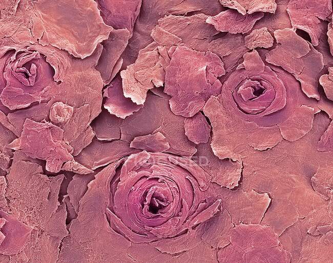 Menschliche Lippen. Farbige Rasterelektronenmikroskopie (REM) einer menschlichen Lippe, die Schweißdrüsenöffnungen auf der trockeneren äußeren Lippenoberfläche zeigt. Diese Öffnungen (Poren) geben Schweiß auf die Hautoberfläche ab — Stockfoto