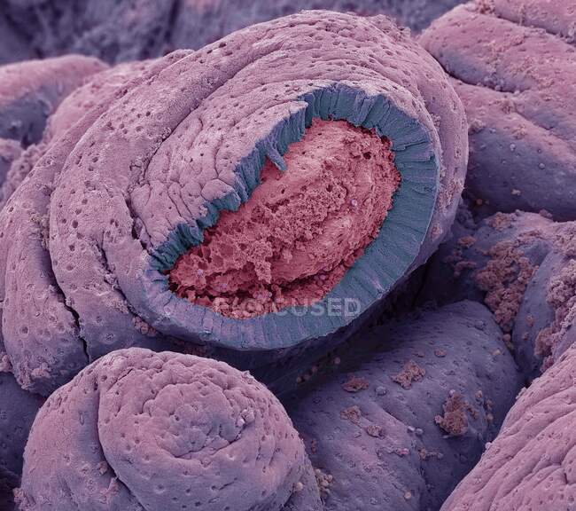 Intestino delgado. Micrografia eletrônica de varredura colorida (MEV) de um congelado fraturado do intestino delgado. A superfície consiste em dobras profundas, chamadas vilosidades. A superfície intestinal (rosa) é exposta a alimentos — Fotografia de Stock