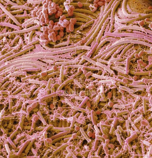 Bakterien aus einer Münze. Farbige Rasterelektronenmikroskopie (REM) von Bakterien aus einer englischen Ein-Pfund-Münze — Stockfoto