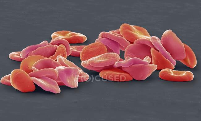 Красные клетки крови. Цветной сканирующий электронный микрограф (СЭМ) красных кровяных телец (РБК, эритроциты). Красные кровяные тельца - двускатные, дискообразные клетки, которые переносят кислород из легких в клетки организма. — стоковое фото