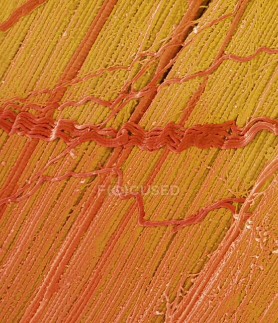 Micrógrafo electrónico de barrido de tendón y color (SEM), que muestra haces de fibras de colágeno. La alineación paralela de las fibras hace que los tendones sean inelásticos pero flexibles. Los tendones unen el músculo al hueso - foto de stock