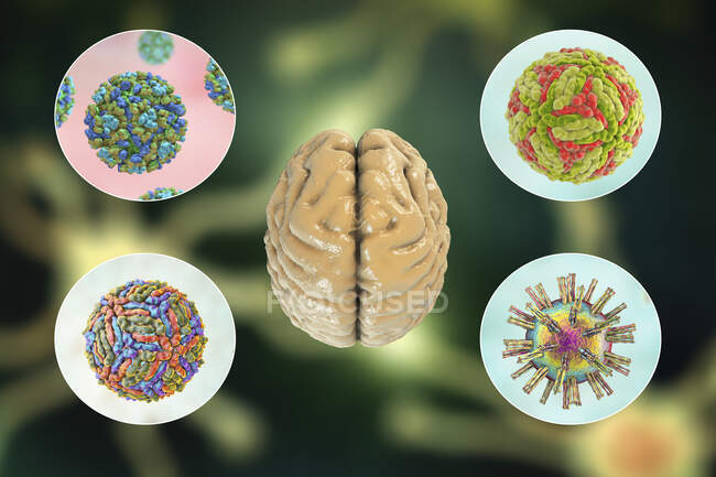 Infecções cerebrais. Ilustração computacional de microrganismos causadores de encefalite e meningite — Fotografia de Stock