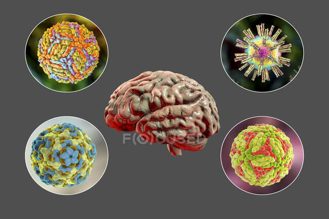 Infezioni cerebrali. Illustrazione computerizzata di microrganismi che causano encefalite e meningite — Foto stock