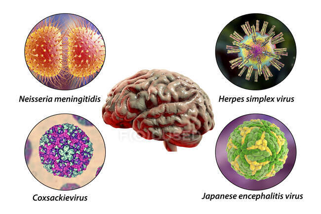 Gehirnentzündungen. Computerillustration von Mikroorganismen, die Enzephalitis und Meningitis verursachen — Stockfoto
