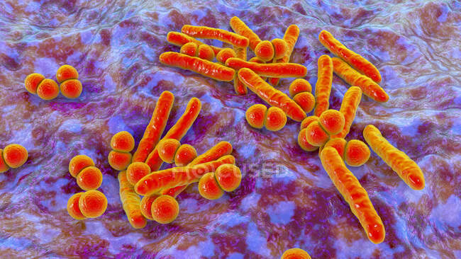 Ilustración por ordenador de la coinfección con dos bacterias patógenas respiratorias principales, Mycobacterium tuberculosis (en forma de vara) y Streptococcus pneumonia (esférica ) - foto de stock