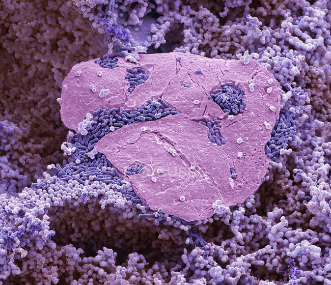Ноги бактерій. Кольоровий сканувальний електронний мікрограф (СЕМ) бактерій, вирощених між пальцями ніг. — стокове фото