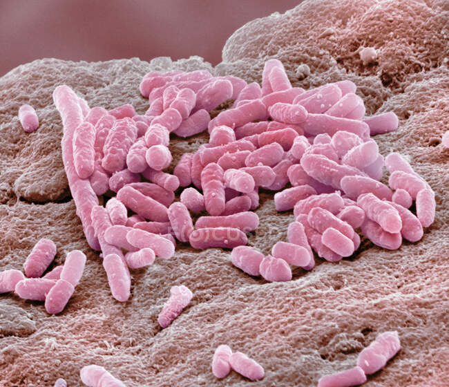 Micrografía electrónica de barrido coloreada de la bacteria Gram-negativa Escherichia coli, en forma de varilla, comúnmente conocida como E. coli - foto de stock